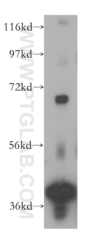 Western Blot (WB) analysis of human testis tissue using DNAJB14 Polyclonal antibody (16501-1-AP)