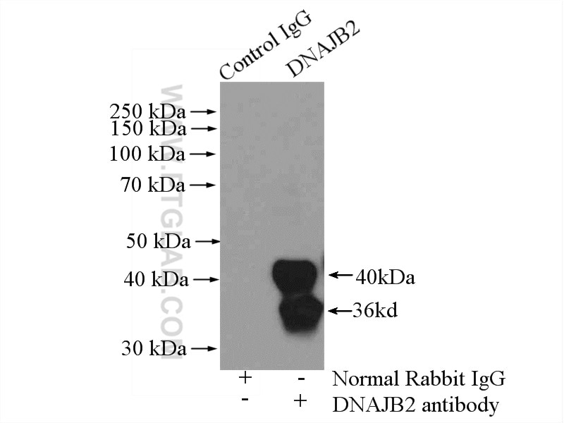 Immunoprecipitation (IP) experiment of mouse brain tissue using DNAJB2 Polyclonal antibody (10838-1-AP)