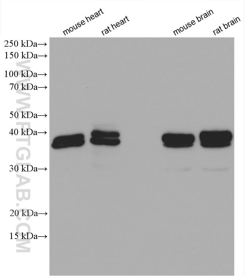 Western Blot (WB) analysis of various lysates using DNAJB2 Polyclonal antibody (10838-1-AP)