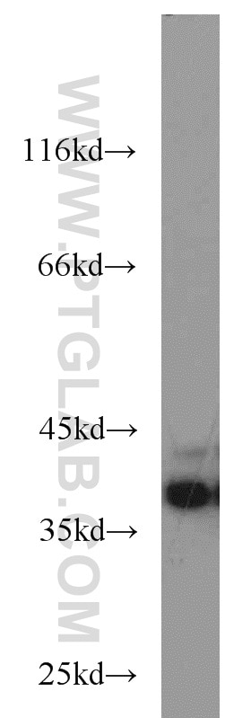 Western Blot (WB) analysis of A431 cells using DNAJB2 Polyclonal antibody (10838-1-AP)