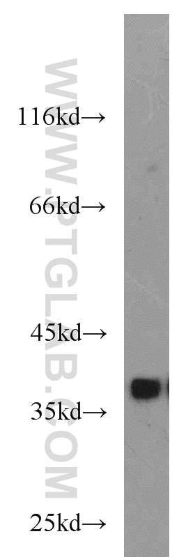 Western Blot (WB) analysis of mouse skeletal muscle tissue using DNAJB2 Polyclonal antibody (10838-1-AP)