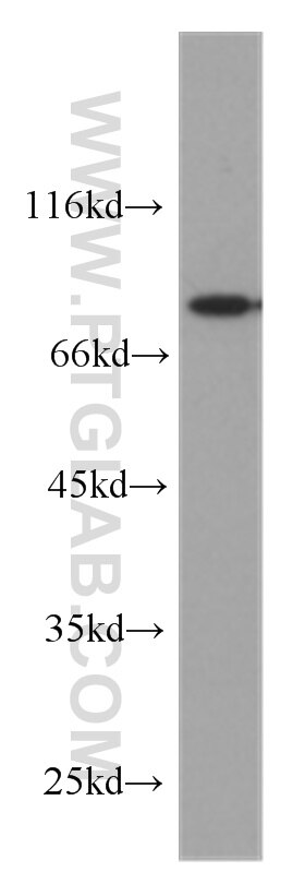 Western Blot (WB) analysis of SH-SY5Y cells using DNAJB2 Monoclonal antibody (60204-1-Ig)
