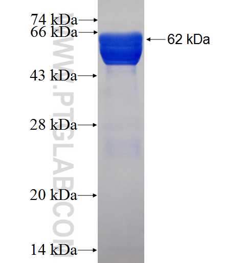 DNAJB2 fusion protein Ag1271 SDS-PAGE