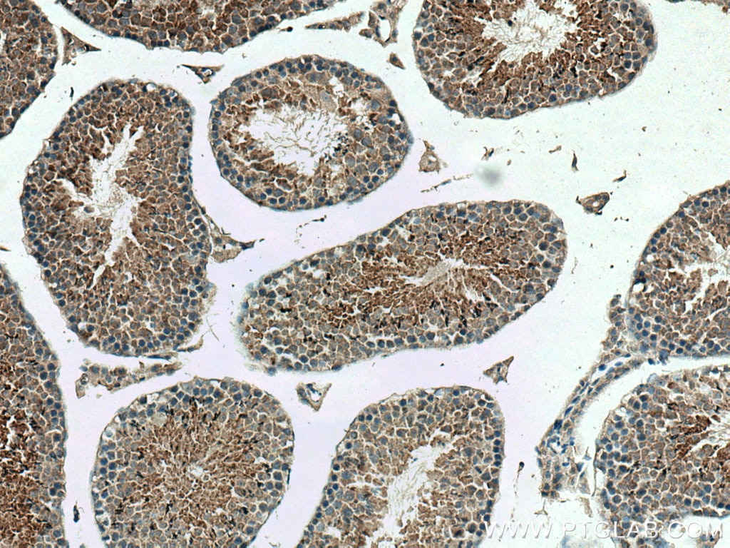Immunohistochemistry (IHC) staining of mouse testis tissue using DNAJB3 Polyclonal antibody (17177-1-AP)