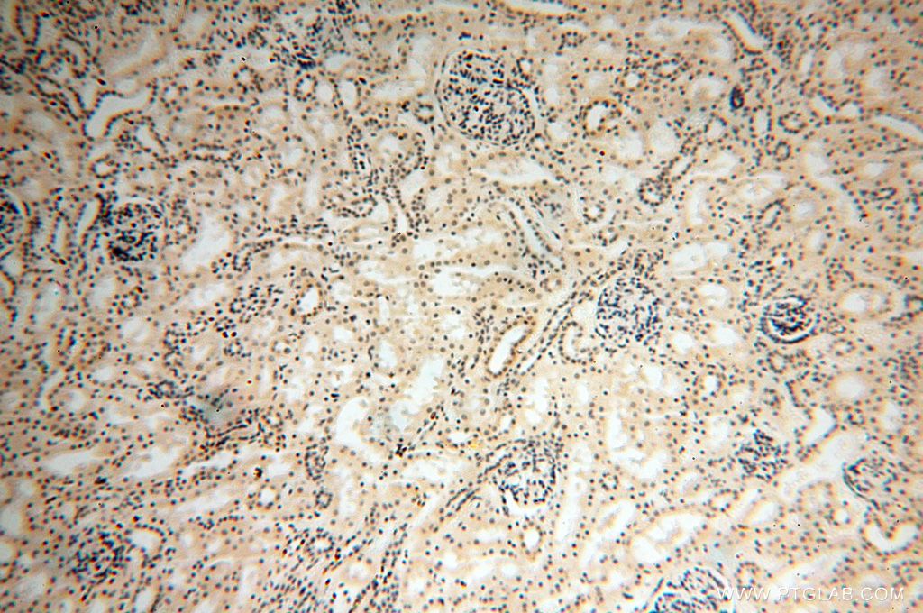 Immunohistochemistry (IHC) staining of human kidney tissue using DNAJB3 Polyclonal antibody (17177-1-AP)