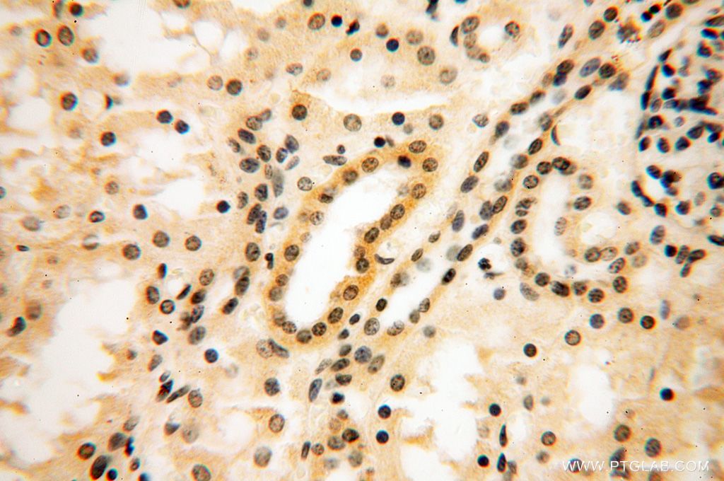 Immunohistochemistry (IHC) staining of human kidney tissue using DNAJB3 Polyclonal antibody (17177-1-AP)