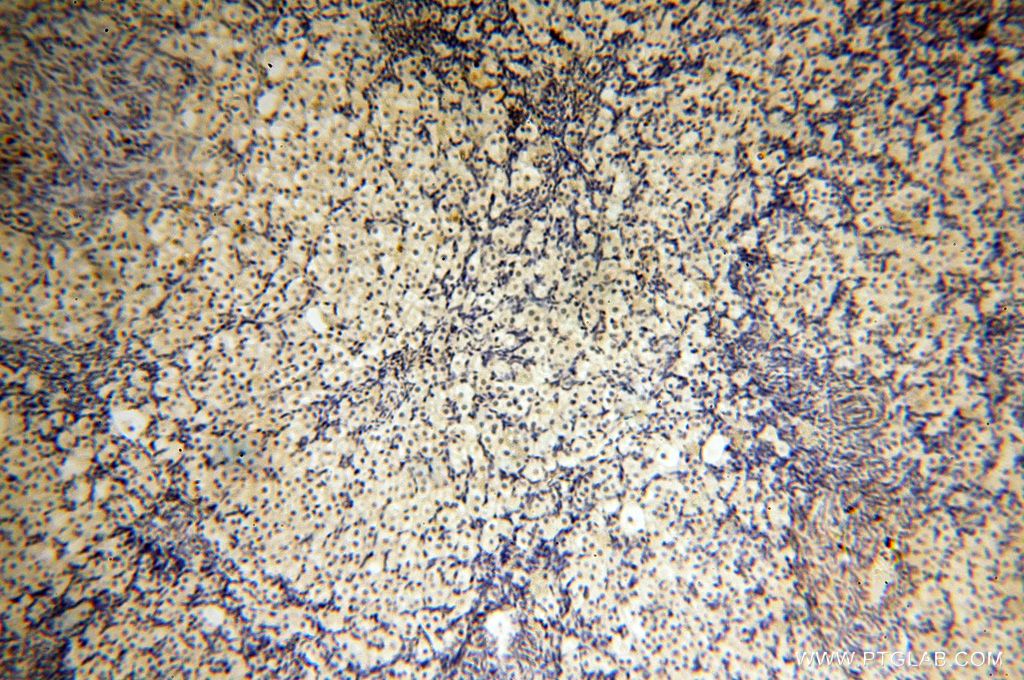 Immunohistochemistry (IHC) staining of human ovary tissue using DNAJB3 Polyclonal antibody (17177-1-AP)