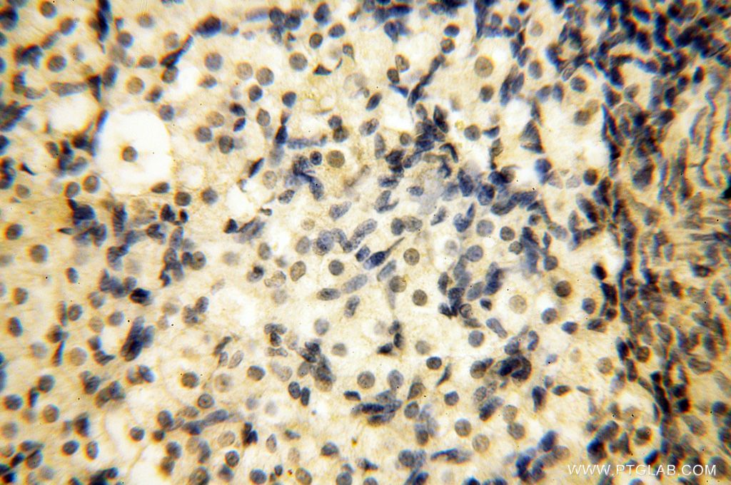 Immunohistochemistry (IHC) staining of human ovary tissue using DNAJB3 Polyclonal antibody (17177-1-AP)