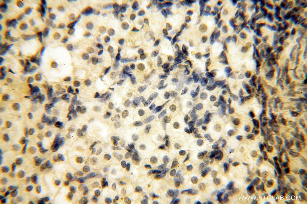 IHC staining of human ovary using 17177-1-AP