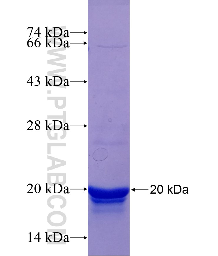 DNAJB3 fusion protein Ag28985 SDS-PAGE