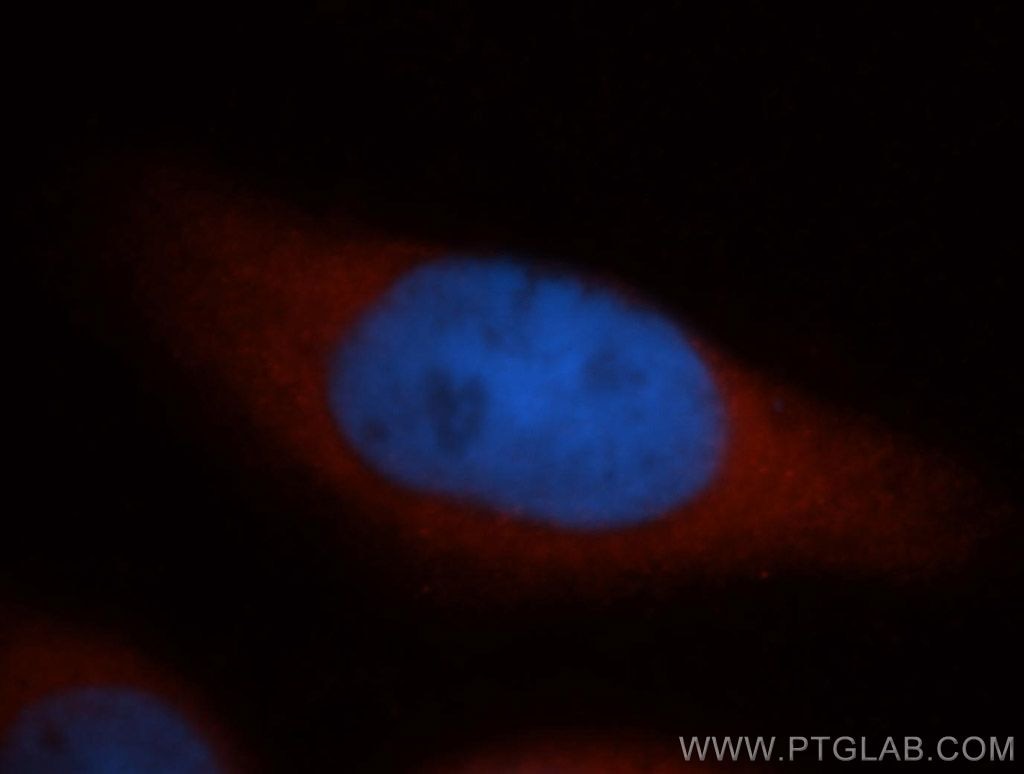 Immunofluorescence (IF) / fluorescent staining of MCF-7 cells using DNAJB4 Polyclonal antibody (13064-1-AP)