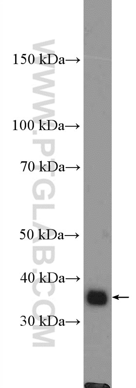 DNAJB4 Polyclonal antibody