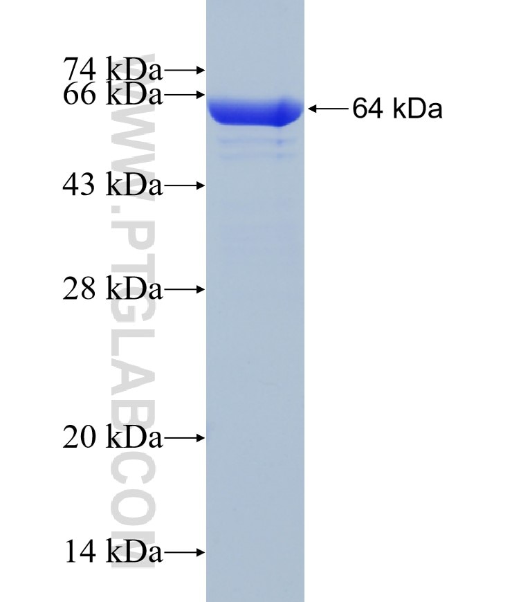 DNAJB4 fusion protein Ag3756 SDS-PAGE