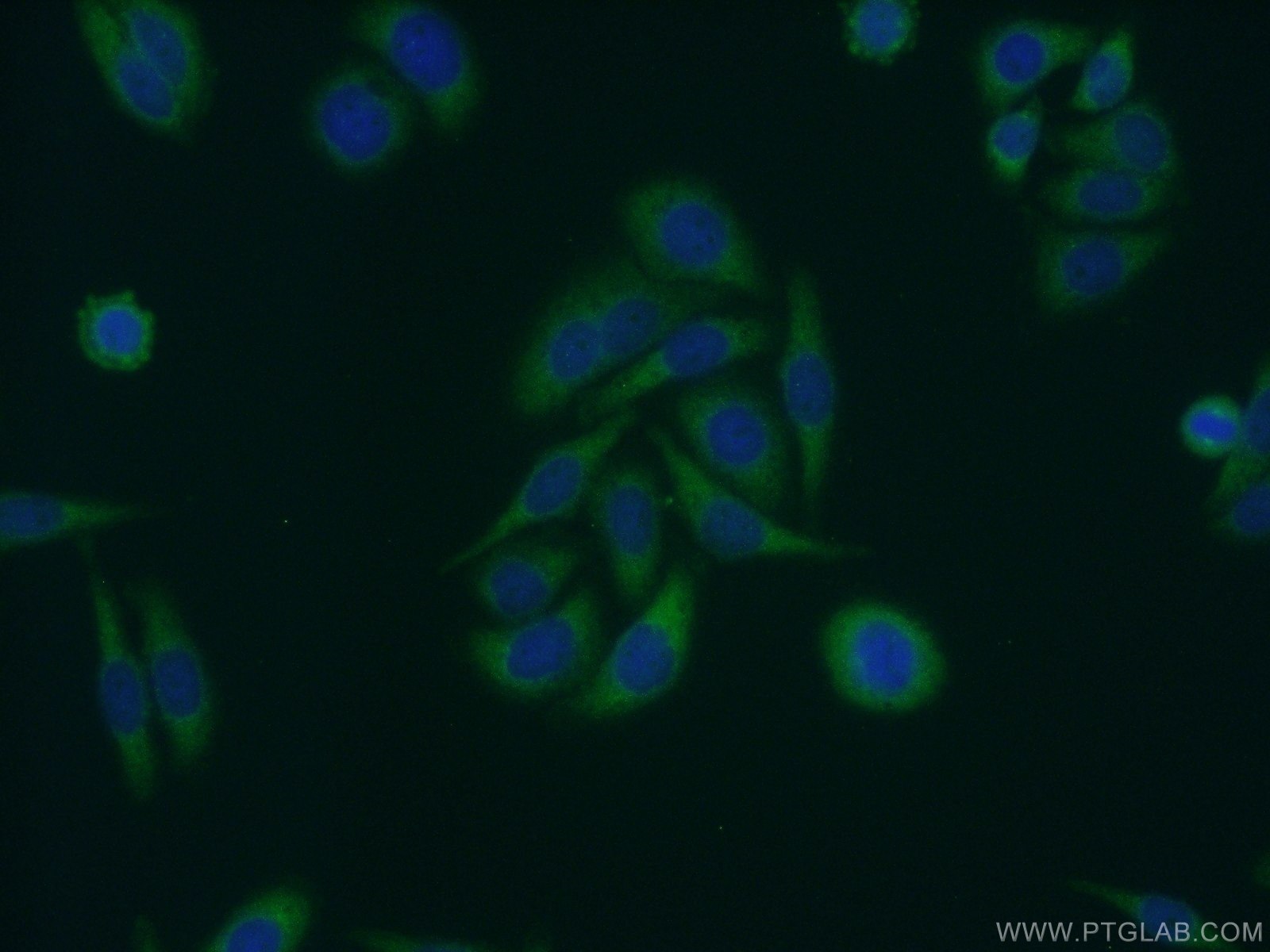 Immunofluorescence (IF) / fluorescent staining of HepG2 cells using DNAJB5 Polyclonal antibody (16453-1-AP)