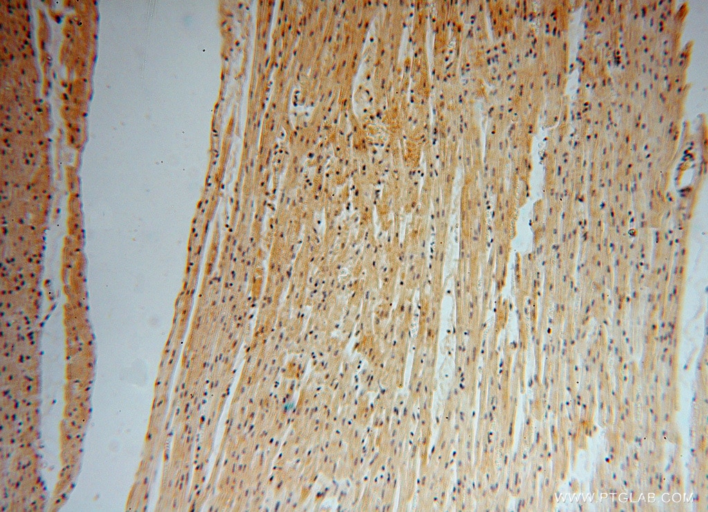 IHC staining of human heart using 16453-1-AP