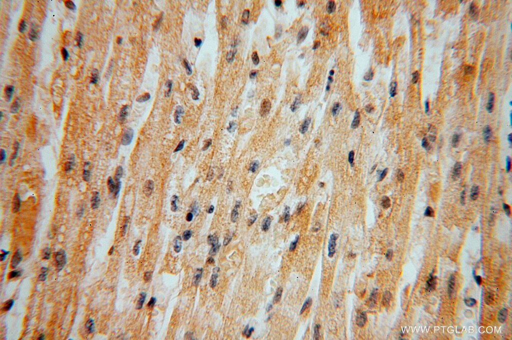 Immunohistochemistry (IHC) staining of human heart tissue using DNAJB5 Polyclonal antibody (16453-1-AP)