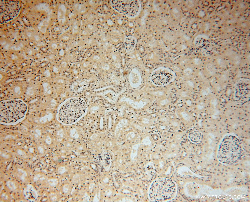 Immunohistochemistry (IHC) staining of human kidney tissue using DNAJB5 Polyclonal antibody (16453-1-AP)