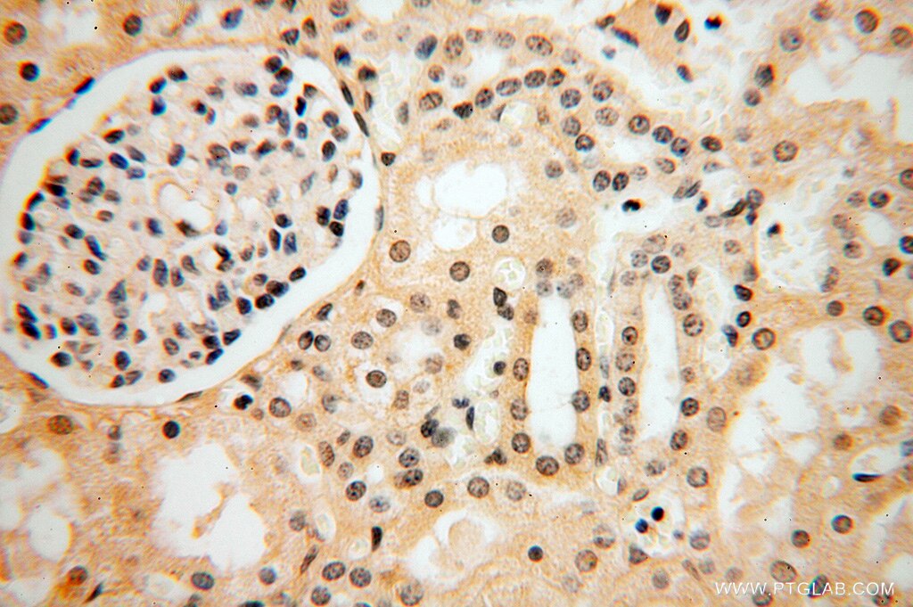 Immunohistochemistry (IHC) staining of human kidney tissue using DNAJB5 Polyclonal antibody (16453-1-AP)