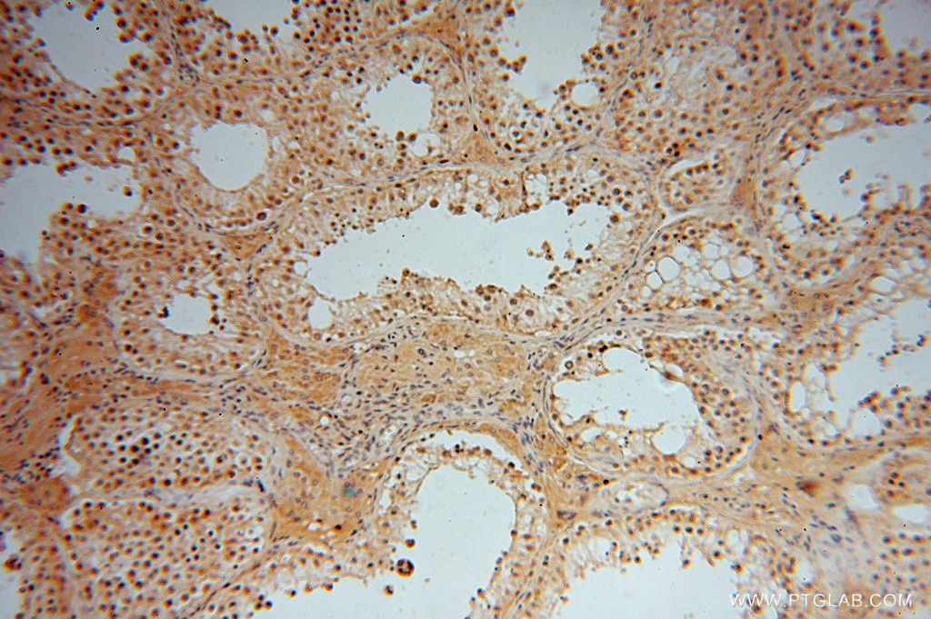 Immunohistochemistry (IHC) staining of human testis tissue using DNAJB5 Polyclonal antibody (16453-1-AP)