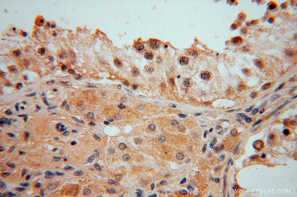 Immunohistochemistry (IHC) staining of human testis tissue using DNAJB5 Polyclonal antibody (16453-1-AP)