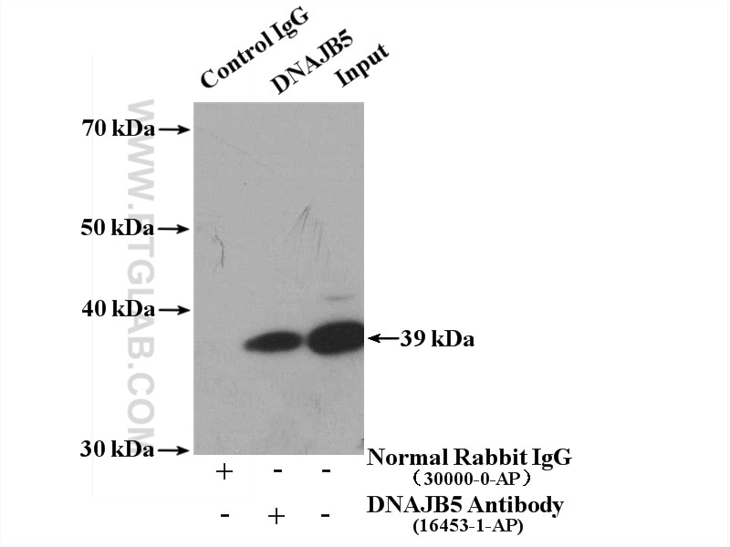 Immunoprecipitation (IP) experiment of HepG2 cells using DNAJB5 Polyclonal antibody (16453-1-AP)