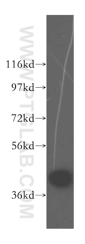 WB analysis of HepG2 using 16453-1-AP