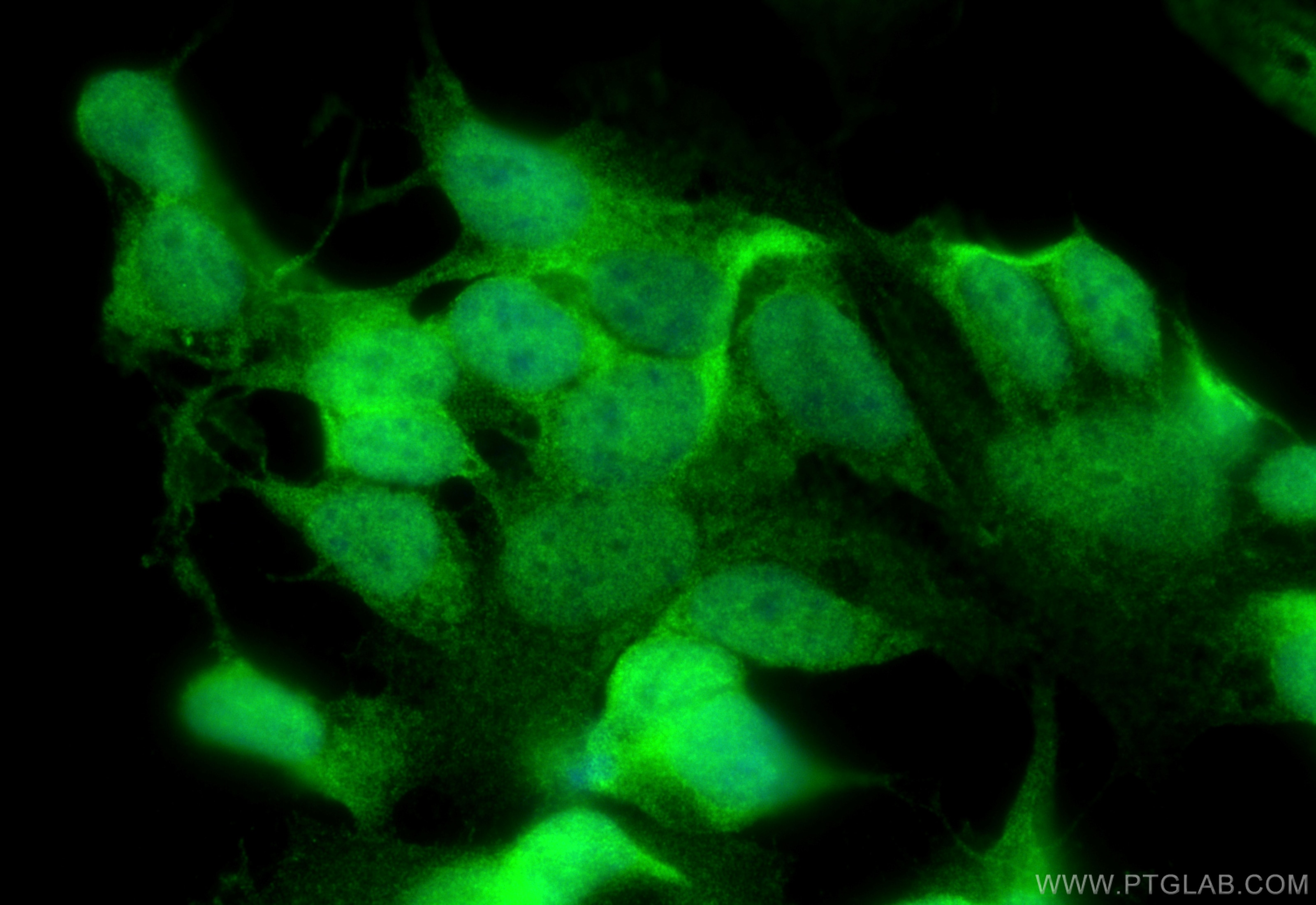 Immunofluorescence (IF) / fluorescent staining of SH-SY5Y cells using DNAJB6 Polyclonal antibody (11707-1-AP)
