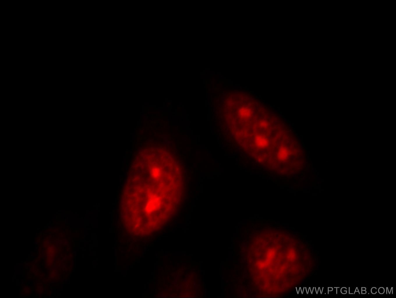 Immunofluorescence (IF) / fluorescent staining of HepG2 cells using DNAJB6 Polyclonal antibody (11707-1-AP)