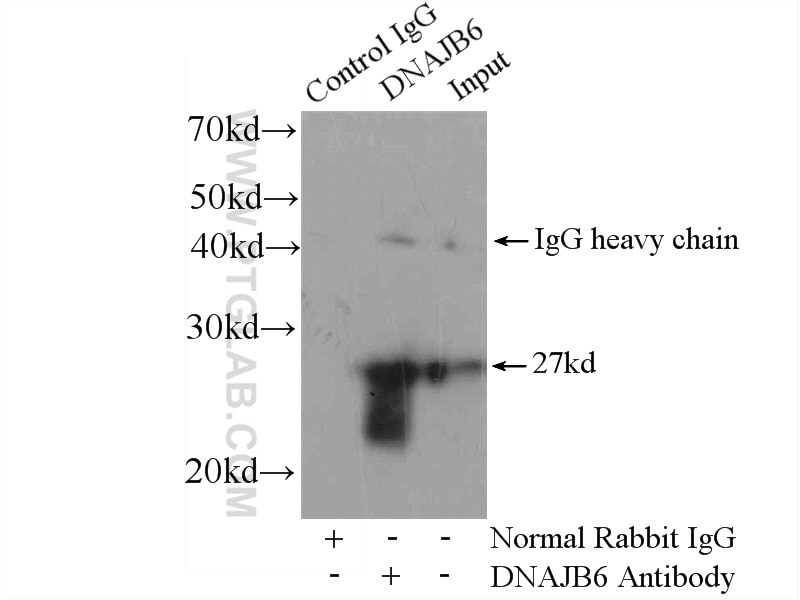 Immunoprecipitation (IP) experiment of mouse brain tissue using DNAJB6 Polyclonal antibody (11707-1-AP)