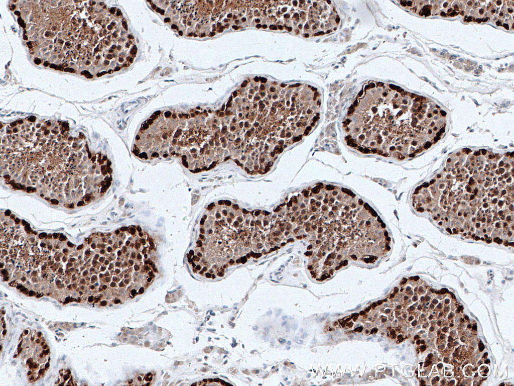 Immunohistochemistry (IHC) staining of human testis tissue using DNAJB6 Monoclonal antibody (66587-1-Ig)