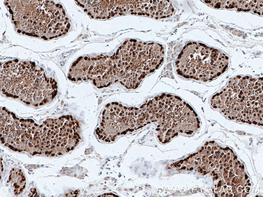 IHC staining of human testis using 66587-1-Ig