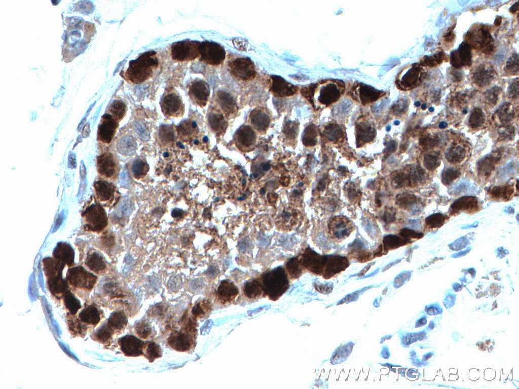 Immunohistochemistry (IHC) staining of human testis tissue using DNAJB6 Monoclonal antibody (66587-1-Ig)