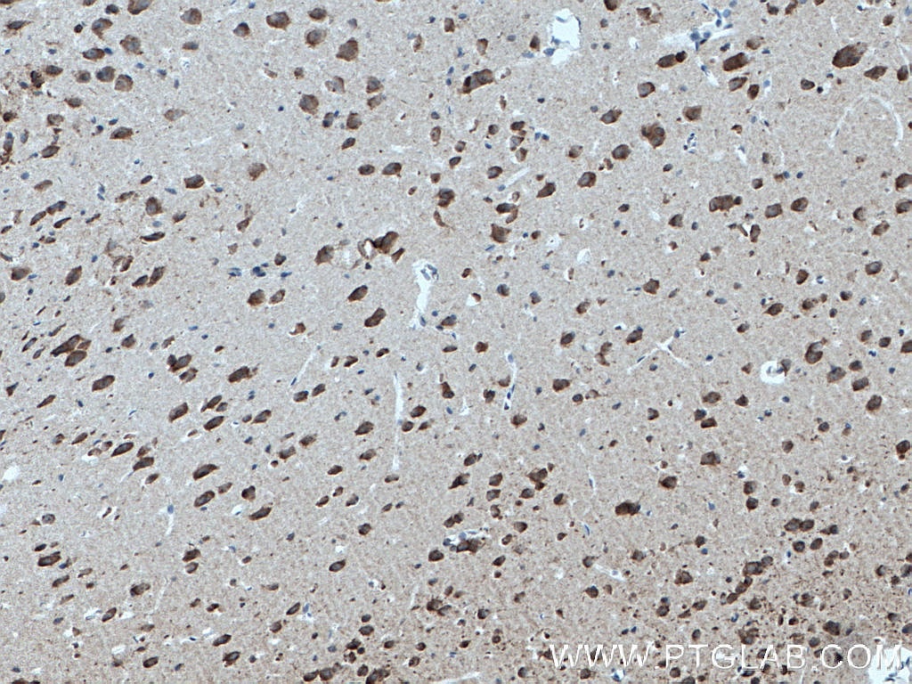 Immunohistochemistry (IHC) staining of mouse brain tissue using DNAJB6 Monoclonal antibody (66587-1-Ig)