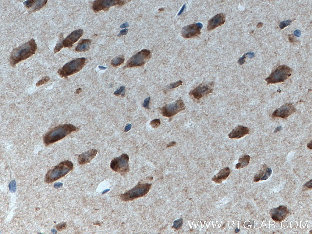 Immunohistochemistry (IHC) staining of mouse brain tissue using DNAJB6 Monoclonal antibody (66587-1-Ig)