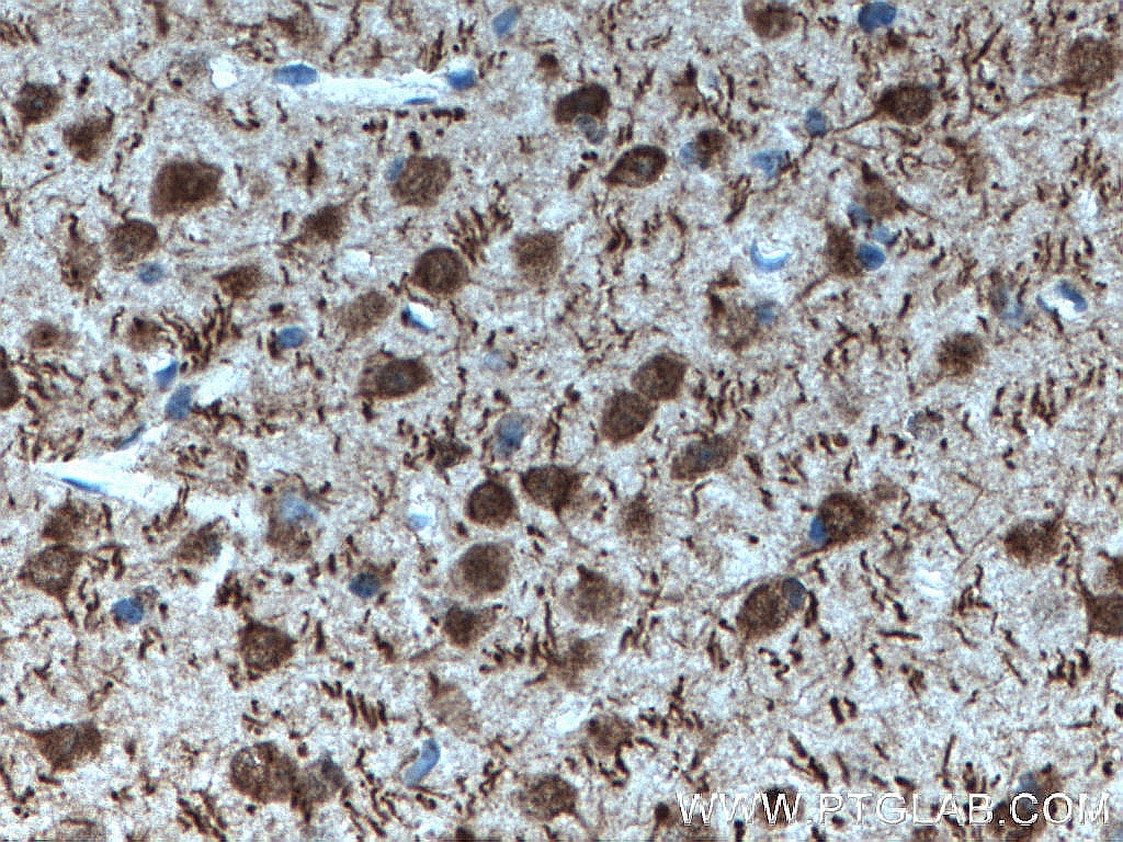 Immunohistochemistry (IHC) staining of mouse brain tissue using DNAJB6 Monoclonal antibody (66587-1-Ig)