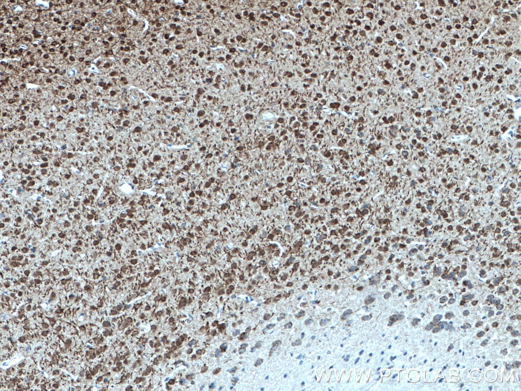 Immunohistochemistry (IHC) staining of mouse brain tissue using DNAJB6 Monoclonal antibody (66587-1-Ig)