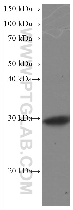 WB analysis of pig brain using 66587-1-Ig