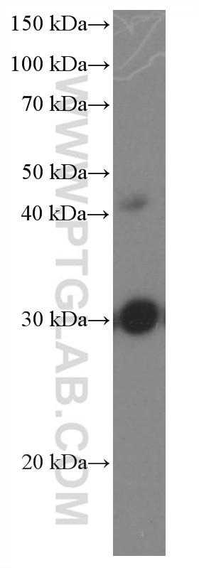 WB analysis of rat brain using 66587-1-Ig