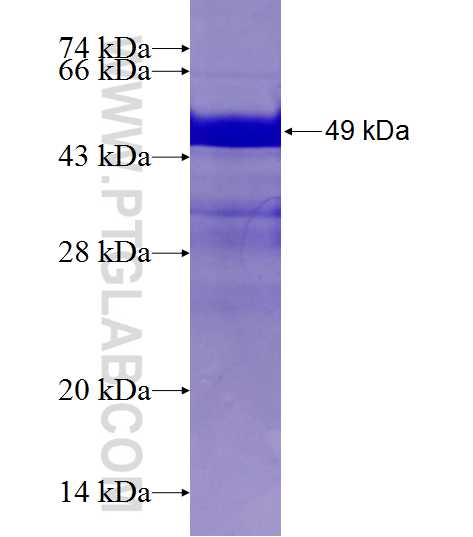 DNAJB6 fusion protein Ag2258 SDS-PAGE