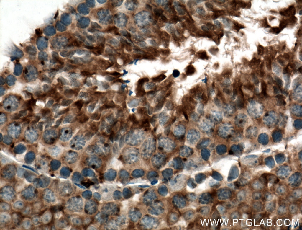 Immunohistochemistry (IHC) staining of mouse testis tissue using DNAJB7 Polyclonal antibody (18540-1-AP)