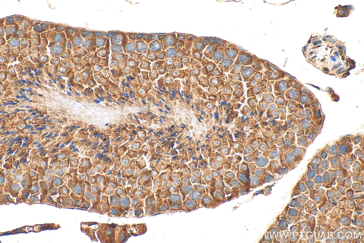 Immunohistochemistry (IHC) staining of mouse testis tissue using DNAJB7 Polyclonal antibody (18540-1-AP)