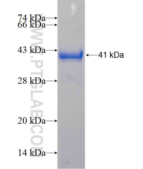 DNAJB7 fusion protein Ag13367 SDS-PAGE
