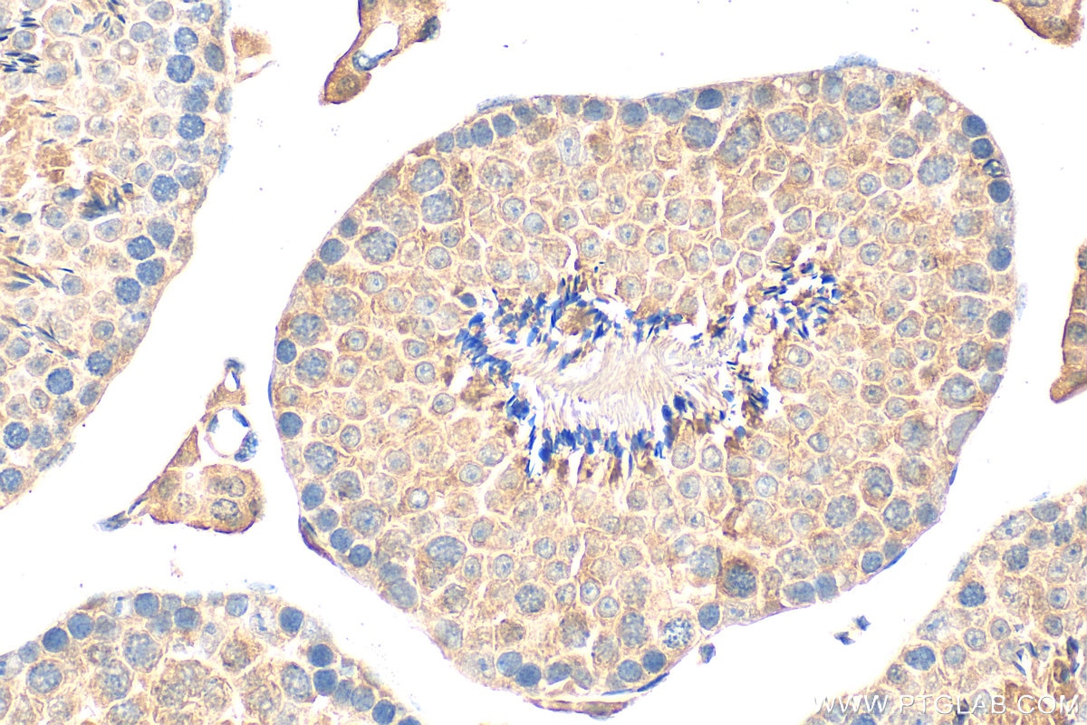 Immunohistochemistry (IHC) staining of mouse testis tissue using DNAJB8 Polyclonal antibody (17071-1-AP)