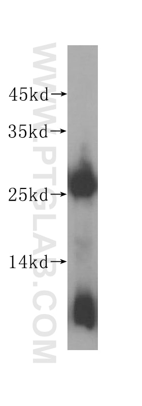 Western Blot (WB) analysis of human brain tissue using DNAJB8 Polyclonal antibody (17071-1-AP)