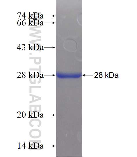 DNAJB8 fusion protein Ag10856 SDS-PAGE