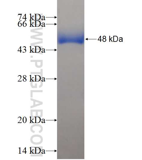 DNAJB8 fusion protein Ag10899 SDS-PAGE