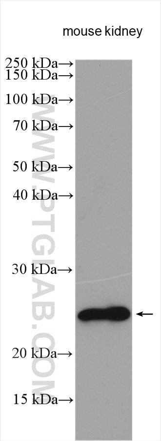 Western Blot (WB) analysis of various lysates using DNAJB9 Polyclonal antibody (13157-1-AP)
