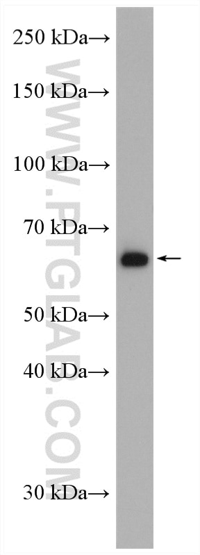 Western Blot (WB) analysis of A549 cells using DNAJC1 Polyclonal antibody (12362-1-AP)