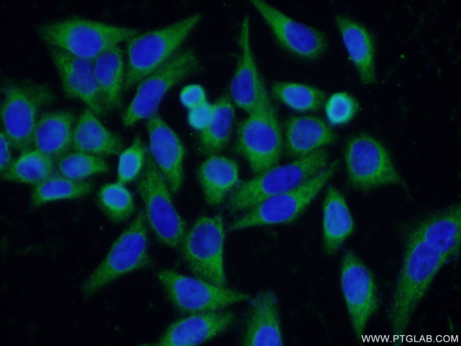 Immunofluorescence (IF) / fluorescent staining of HeLa cells using DNAJC10 Polyclonal antibody (13101-1-AP)