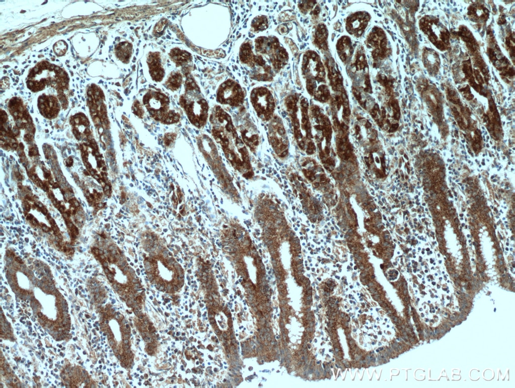 IHC staining of human stomach using 13101-1-AP
